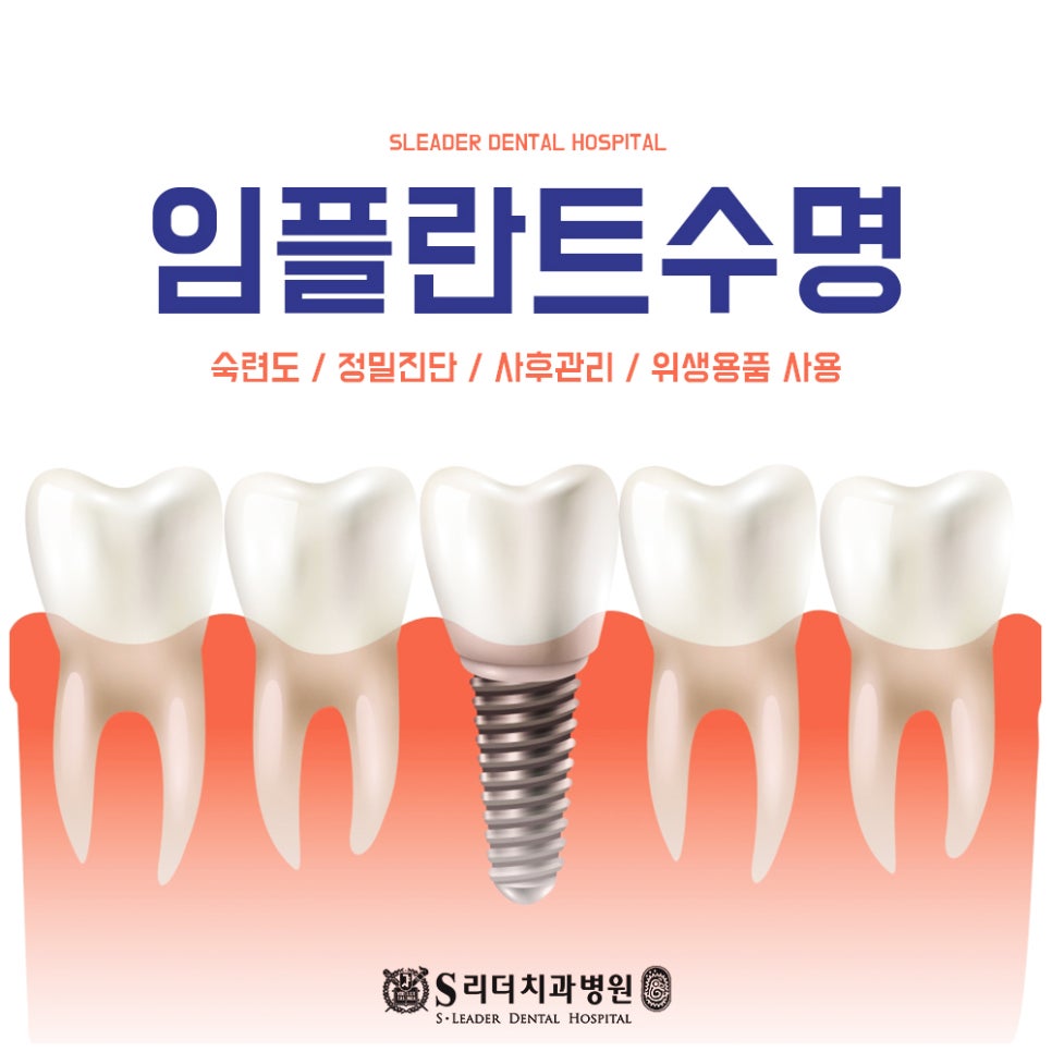 건대치과 임플란트구조 이해하면 관리하기에 도움이 되는 관련 이미지 5