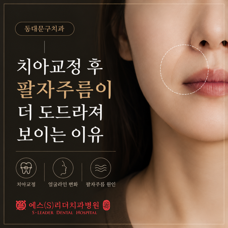 Dongdaemun-gu Dental Clinic | Why Nasolabial Folds Look More Pronounced After Orthodontic Treatment image 1