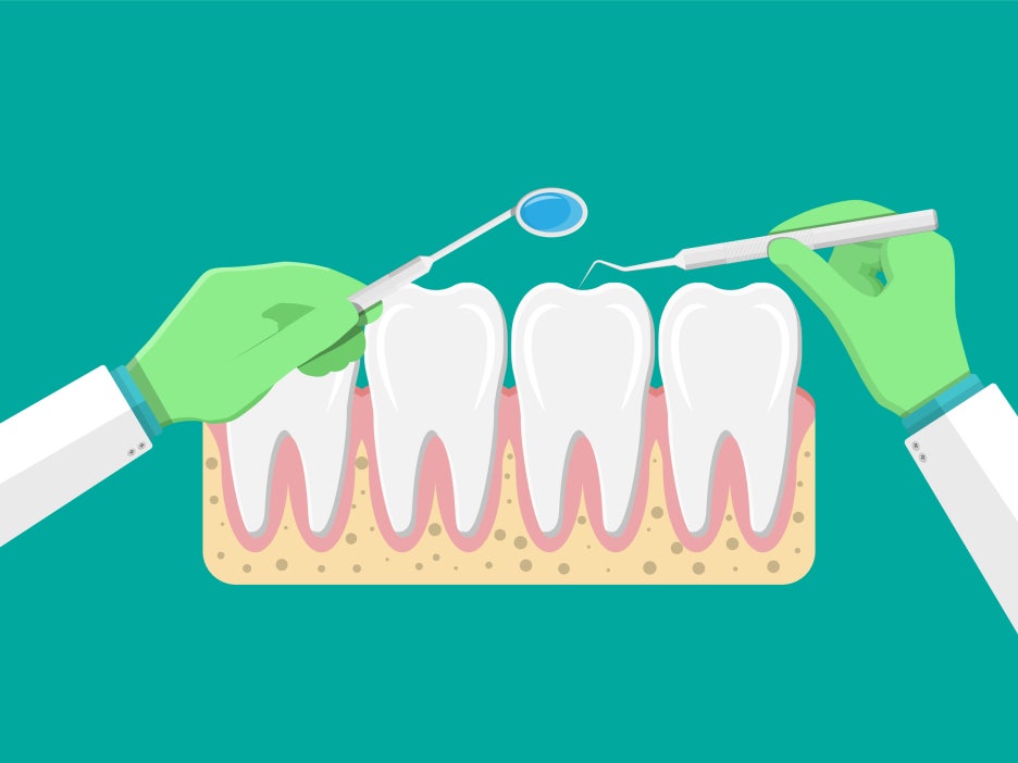 3 Important Things to Note About Chronic and Acute Periodontitis image 7