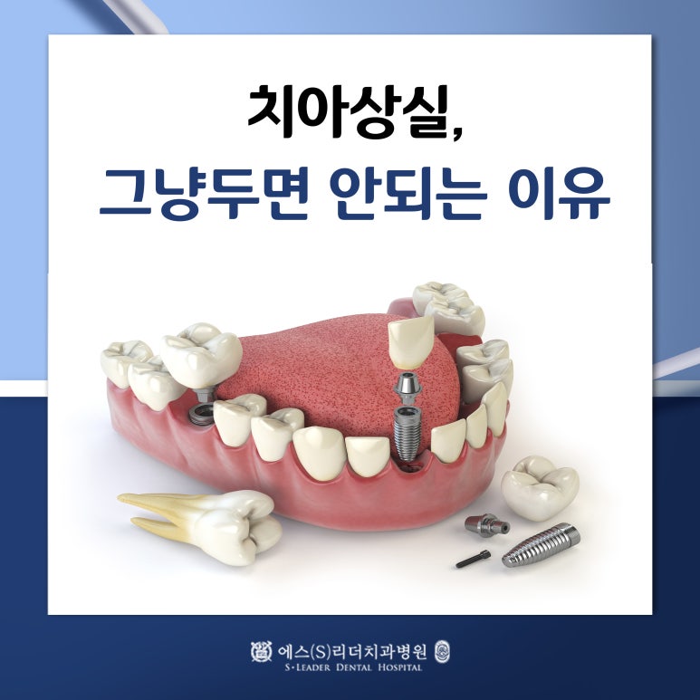 [Jayang-dong Dental Clinic] Why Tooth Loss Should Not Be Left Untreated image 1