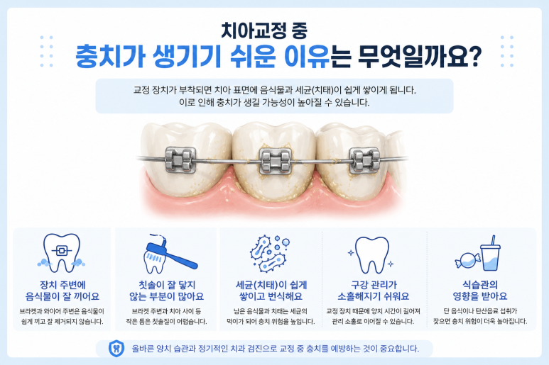 How Is a Cavity Treated If It Develops During Orthodontic Treatment at Neungdong Dental Clinic? image 2