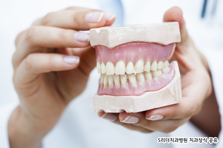치아교정 필요한 이유 겉모습 때문만이 아닌 이유 관련 이미지 2