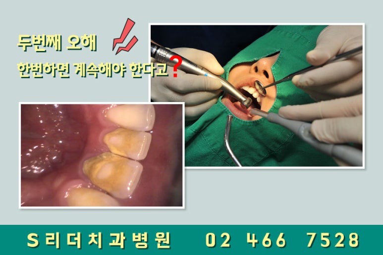 광진구치과 스케일링 오해하지마세요~ 관련 이미지 3