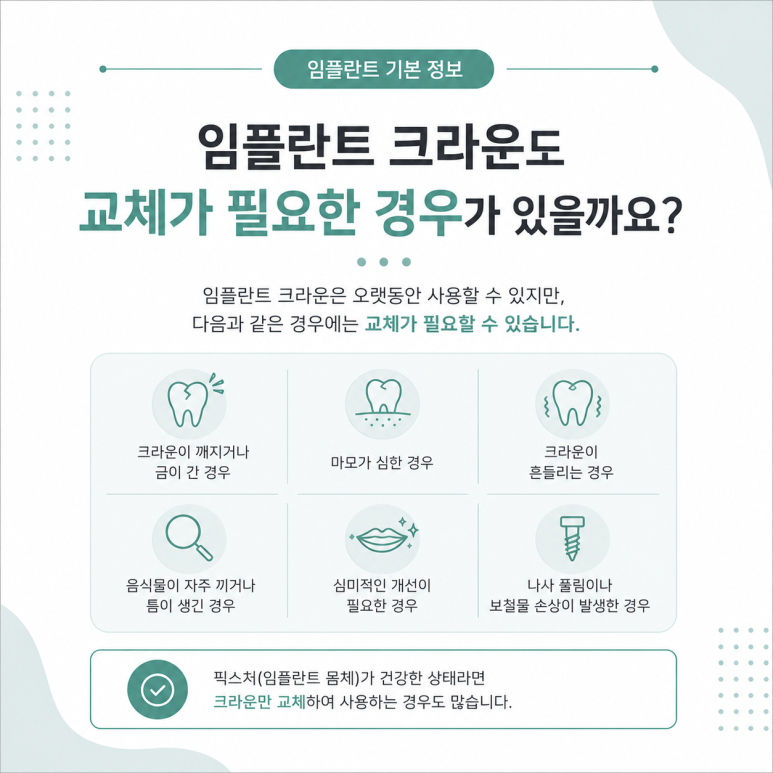 광진구임플란트 크라운은 얼마나 오래 사용할 수 있을까요? 관련 이미지 5