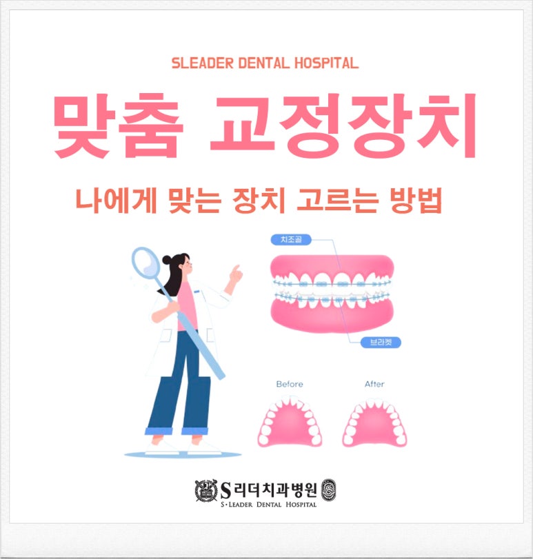 서울치아교정, 투명&middot;부분&middot;설측 등 나에게 맞는 장치 고르는 방법 관련 이미지 1