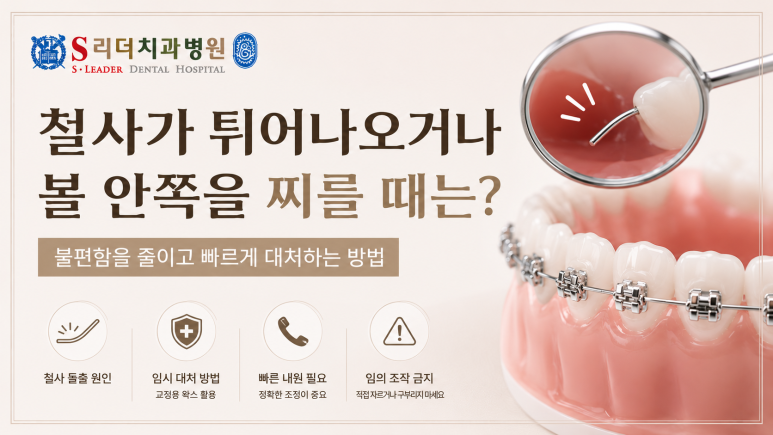 광진구치과|교정 장치가 떨어졌을 때 대처 방법, 그냥 두어도 괜찮을까요? 관련 이미지 4
