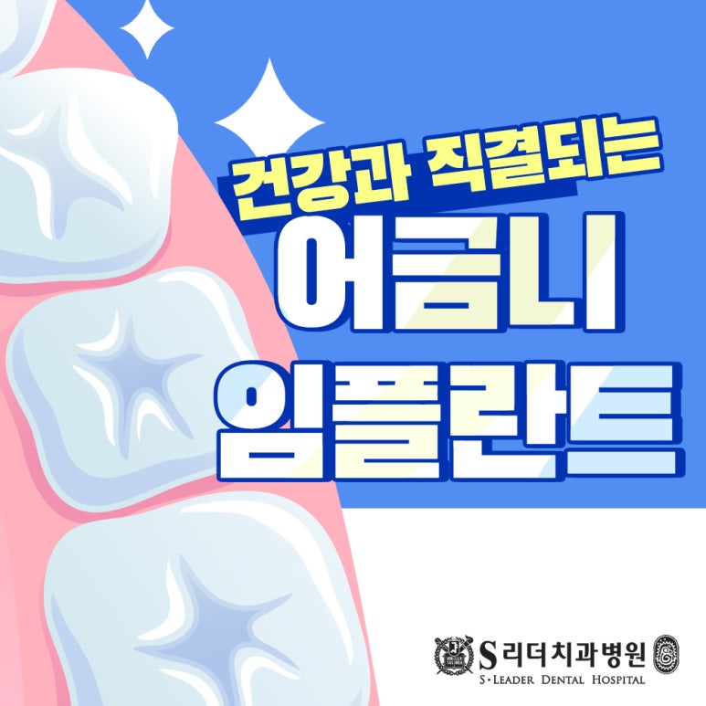 [Gwangjin-gu Implant] Important Things to Check Before Getting a Molar Implant and Its Cost image 1