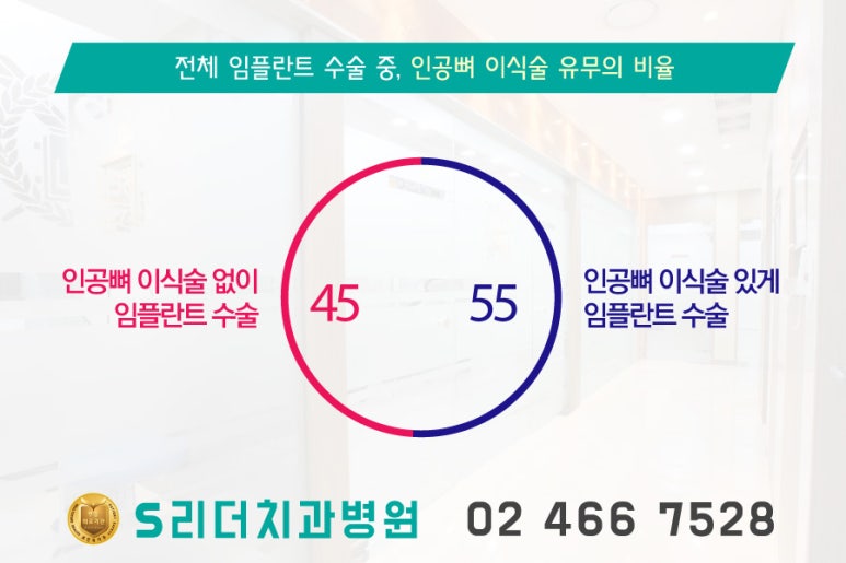 광진구치과 임플란트 성공 노하우?! 관련 이미지 2