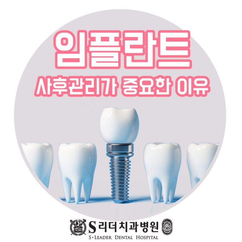 건대입구임플란트 사후관리가 중요한 이유에 대해 관련 이미지 1