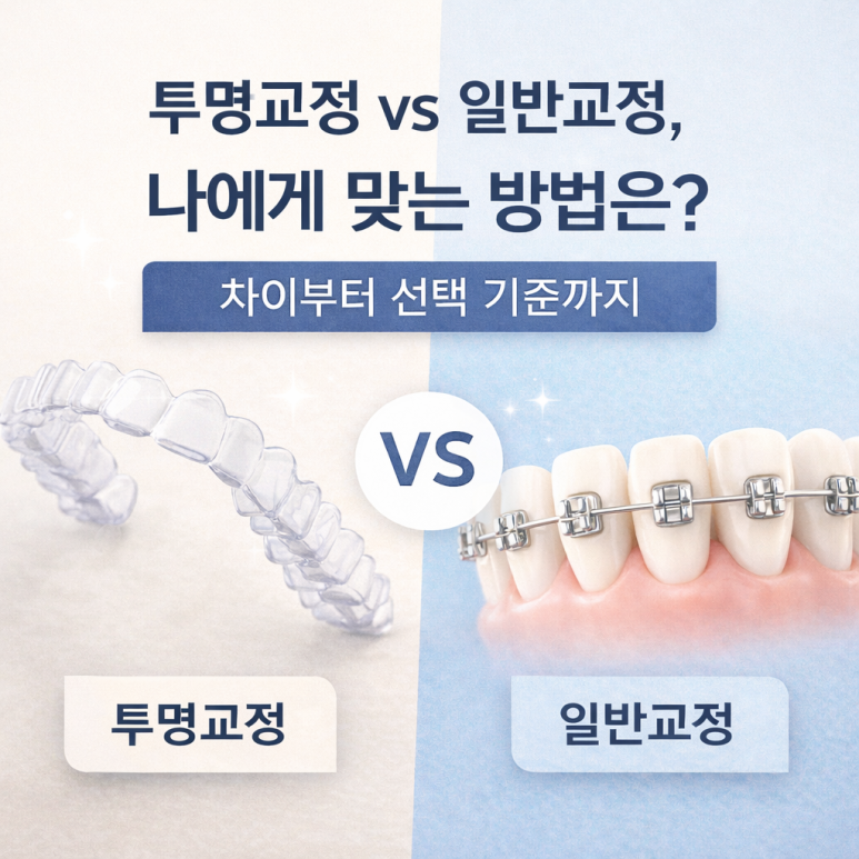 Seoul Night Dental | Clear Aligners vs. Traditional Braces: Which Is Right for Me? From Differences to Selection Criteria image 1