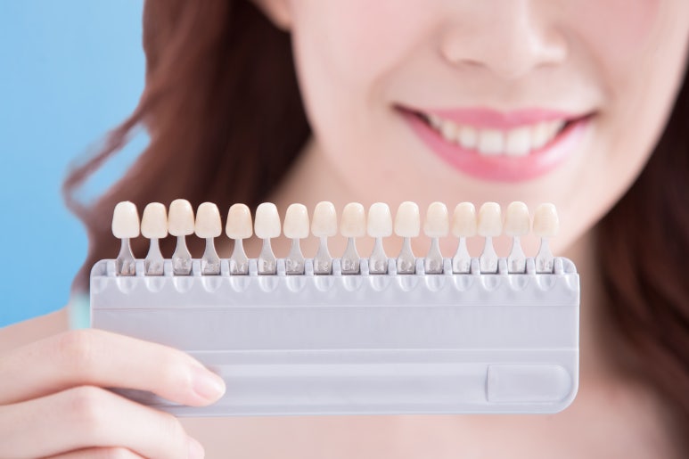 건대 치아미백, 누런 앞니 때문에 고민이시라면? 관련 이미지 4