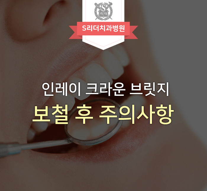보철치료 후 주의사항 인레이부터 크라운까지 모두 알아보기 관련 이미지 1