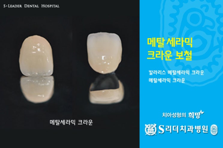 건대치과 치아성형 잘하는 곳 궁금해? 관련 이미지 9