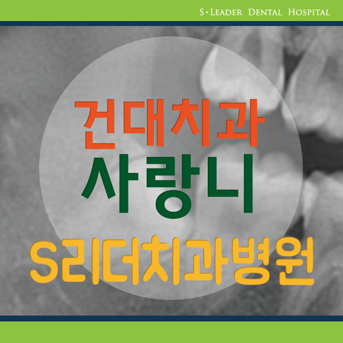 건대치과 사랑니는 왜 나올까? 관련 이미지 1