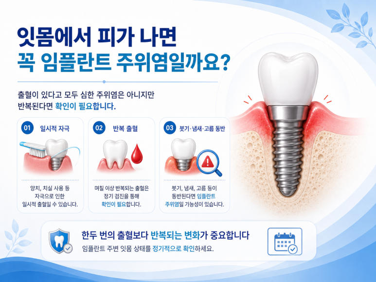 광진구치과 임플란트 주위염은 왜 생길까요? 잇몸에서 피가 난다면 확인해야 할 것 관련 이미지 4