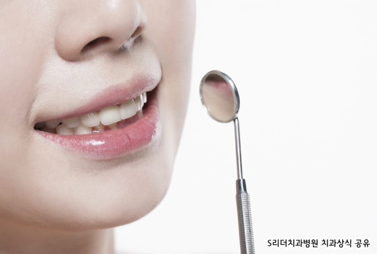 벌어진 앞니치료에 대한 솔직한 이야기 관련 이미지 2
