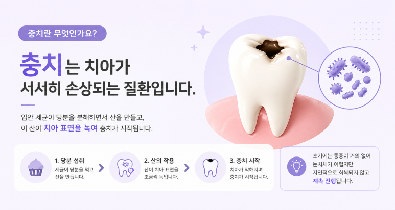 Sanggye-dong Dental Clinic: Step-by-Step Process of Cavity Treatment and Why Treatment Differs image 2