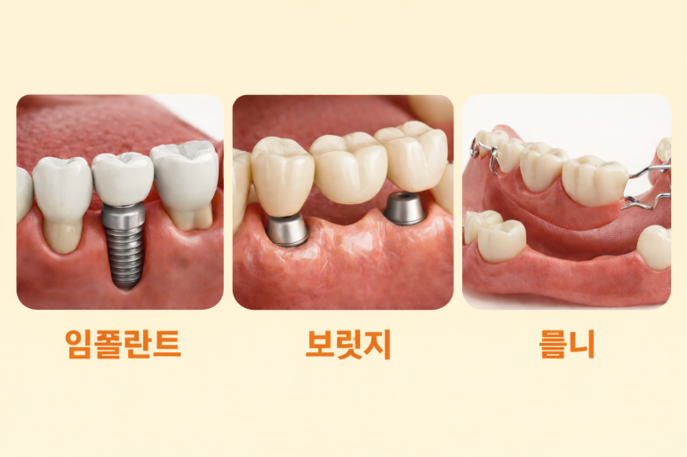 Gwangjin-gu Implants, A Complete Comparison of Bridges and Dentures | Which Option Is Right for Me? image 3