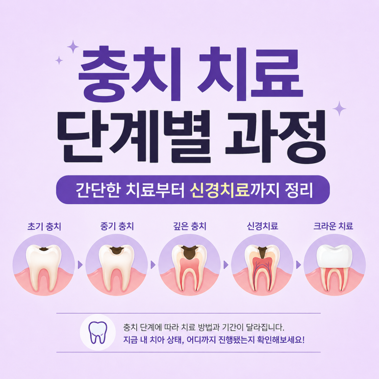 Sanggye-dong Dental Clinic: Step-by-Step Process of Cavity Treatment and Why Treatment Differs image 1
