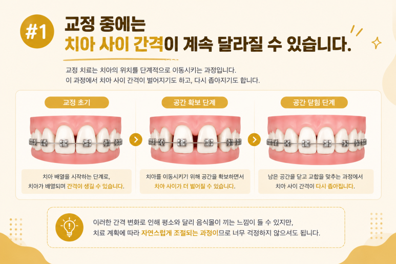 Mangu-dong Dental Clinic: Why Food Keeps Getting Stuck Between Your Teeth During Orthodontic Treatment and How to Manage It image 3