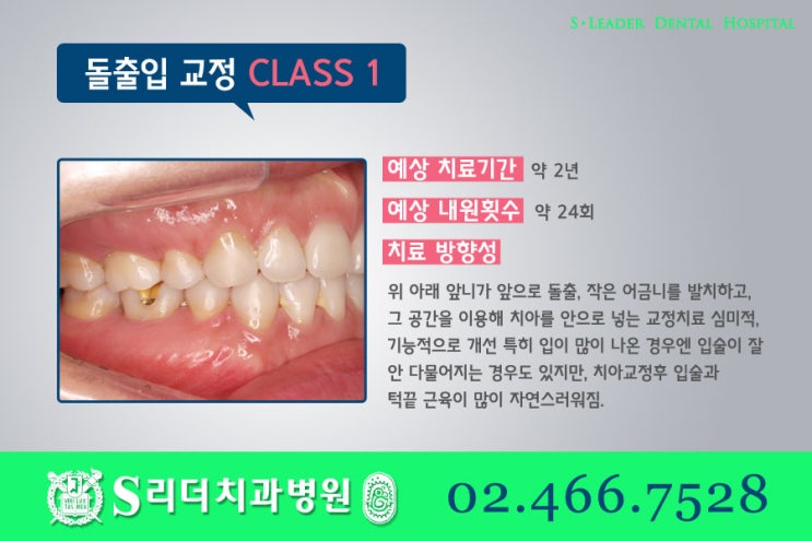 건대교정치과 똑같은 돌출입치아교정이 아니라는 점. 관련 이미지 5