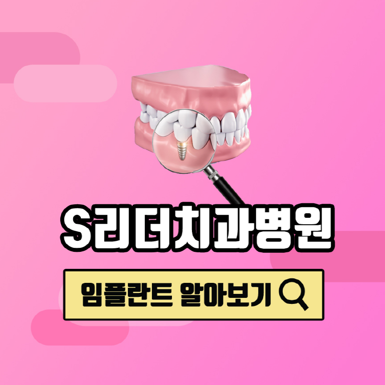 서울임플란트치과 임플란트 시술, 꼼꼼하게 확인하세요 관련 이미지 1