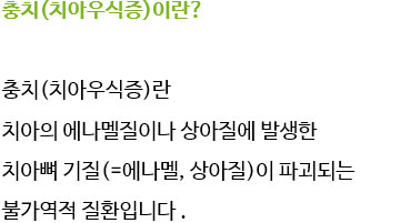 충치(치아우식증)예방 자양동치과,화양동치과 관련 이미지 4