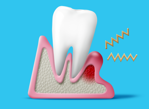 Three Things to Know Before Getting Dental Implants at a Gwangjin-gu Dental Clinic image 8