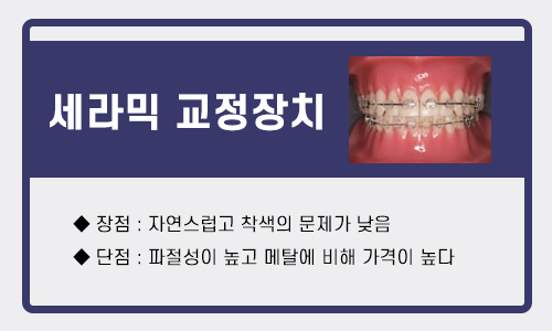 건대입구교정치과 각 교정장치의 장단점 관련 이미지 3