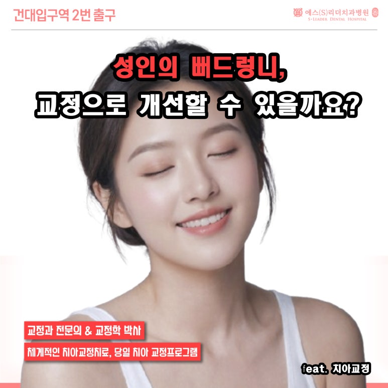 [서울교정치과] 성인의 뻐드렁니, 교정으로 개선할 수 있을까요? 관련 이미지 1