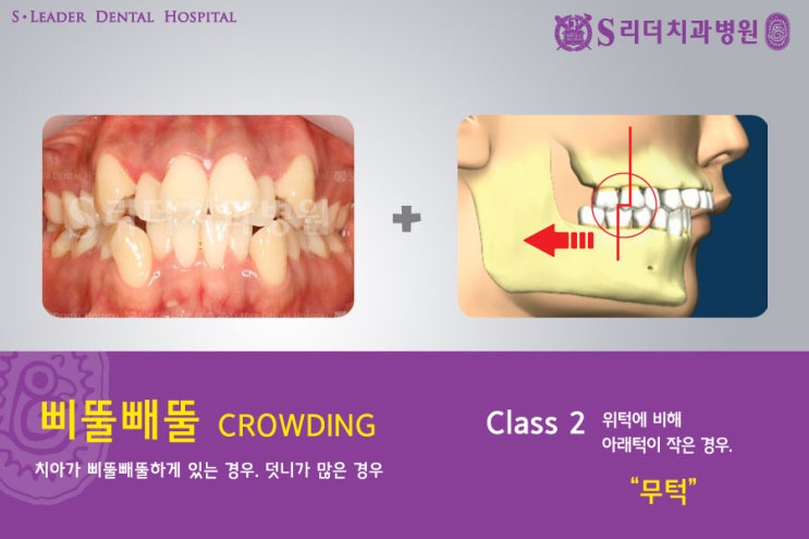 건대교정치과 내 마음에 쏙 드는 교정치과 어때요? 관련 이미지 5