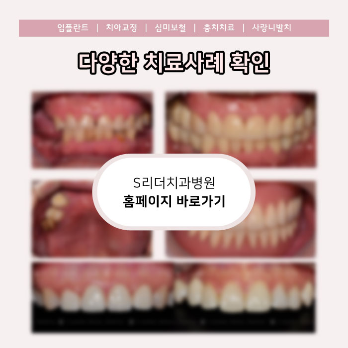 성수동치과 정확하게 진단받고 치료하고 싶다면 관련 이미지 5