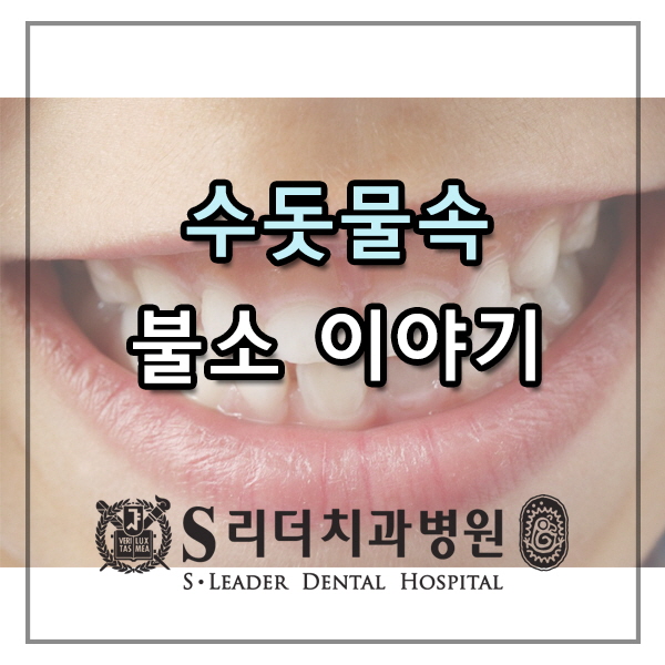 광진구치과추천 수돗물속 불소의 효과 관련 이미지 1