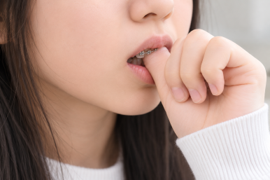 광장동치과 교정 후 다시 틀어지는 이유와 재교정이 필요한 경우 관련 이미지 5