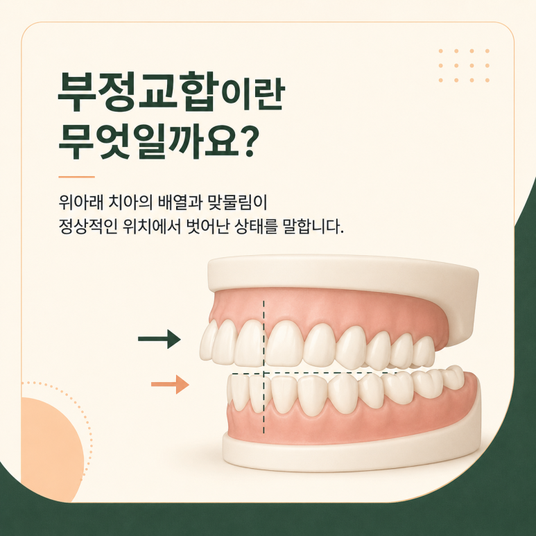 Konkuk University Station Dental Clinic: What Is Malocclusion? A Complete Overview of Its Types and Characteristics image 2