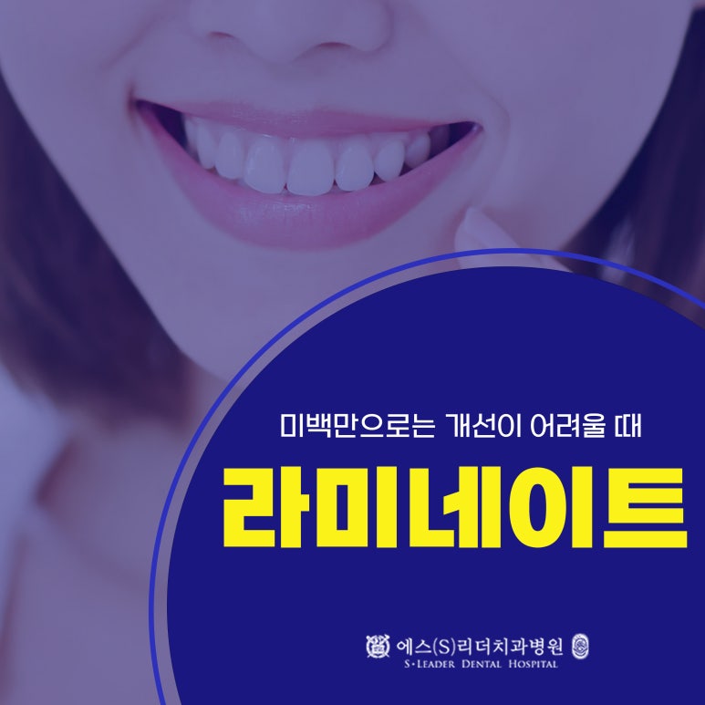 Myeonmok-dong Dental Clinic, Are You Considering Laminates? image 1
