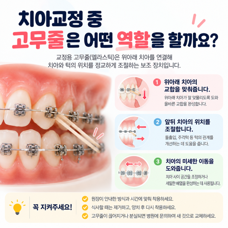 화양동치과, 치아교정 중 고무줄은 왜 착용해야 할까? 관련 이미지 2