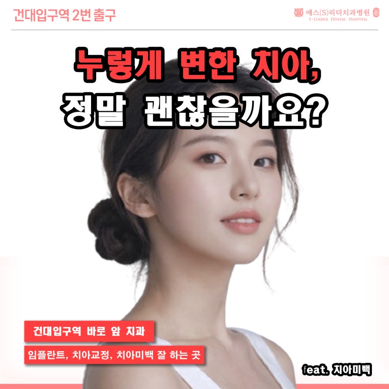 [Gwangjin-gu Teeth Whitening] Are Yellowing Teeth a Concern for You? image 1