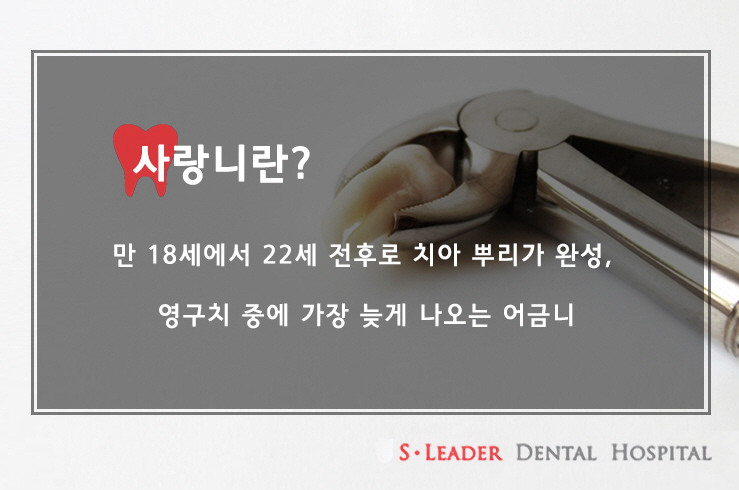 화양동치과 사랑니 도대체 왜생기나요? 관련 이미지 2
