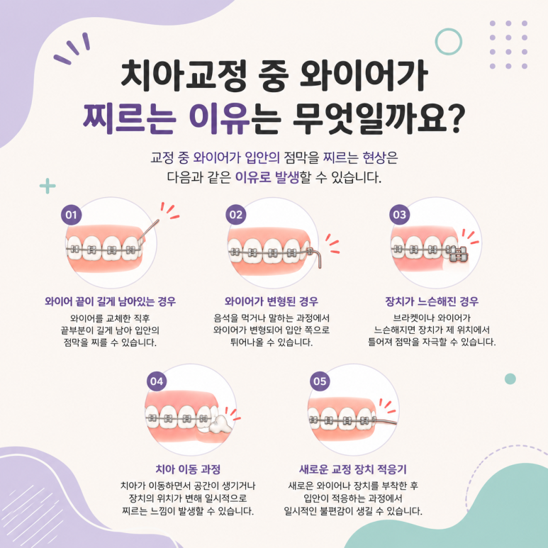 송정동치과 치아교정 중 와이어가 찌를 때 대처 방법은 무엇일까요? 관련 이미지 2