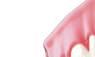 서울치과병원 초고령화사회일 수록 노인임플란트 혜택 받아보세요 관련 이미지 17