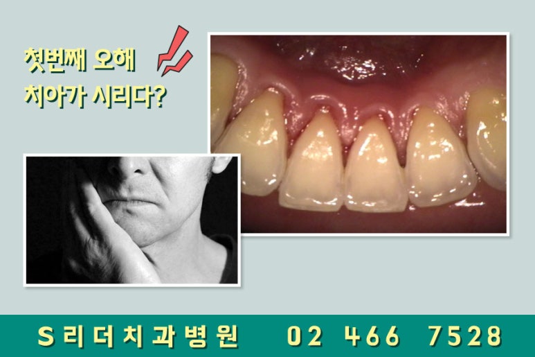광진구치과 스케일링 오해하지마세요~ 관련 이미지 2