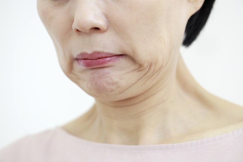 [Jungnang-gu Dental Clinic] Habits You Must Keep After Dental Implants image 5