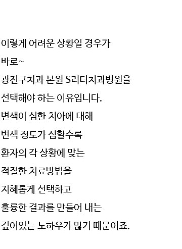 앞니치아성형 내마음에 쏙~들려면 관련 이미지 11