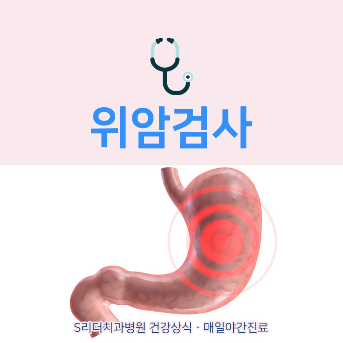 위암검사 바람직한 시기, 알고 받으세요! 관련 이미지 1