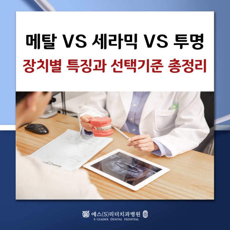 [중랑구치과] 교정 장치, 어떤 걸 선택해야 할까요? 관련 이미지 1