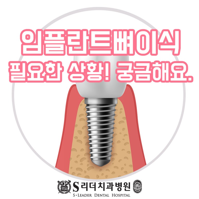 면목역치과 임플란트뼈이식이 필요한 경우는 언제일까 관련 이미지 1