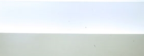 광진구임플란트 신중히 결정해야 하는 이유에 대해 관련 이미지 12