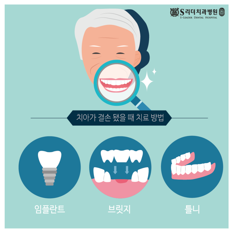 어금니깨짐 부러짐 깊은 파절 방치하지 말고 관련 이미지 3
