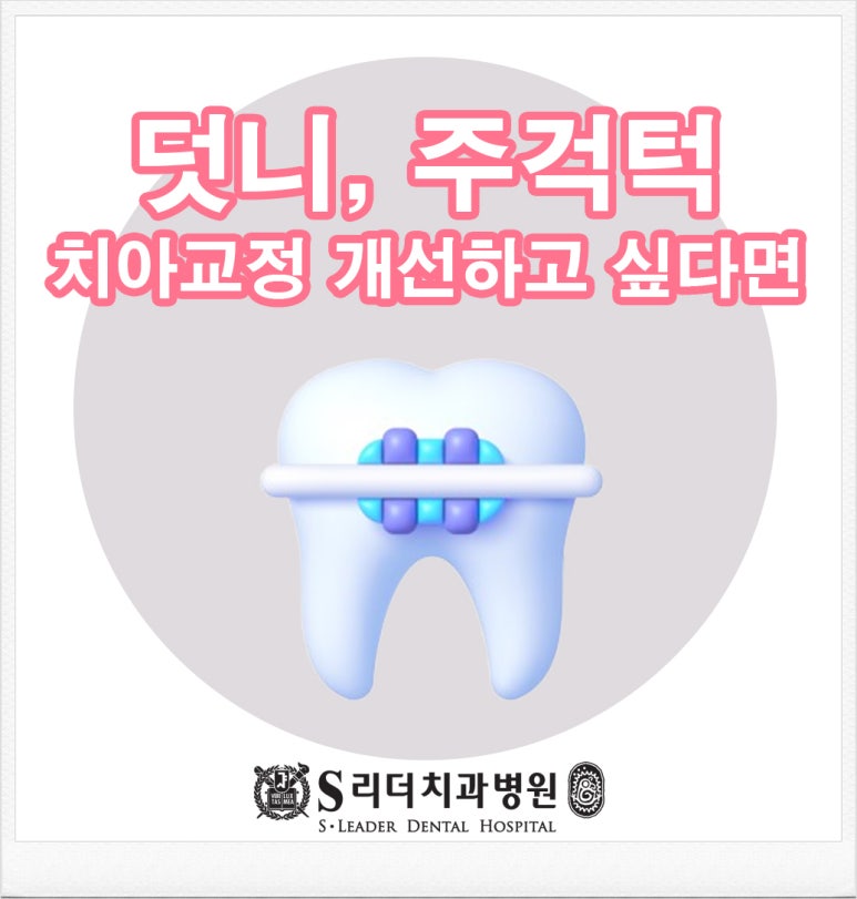 용마산역치과, 덧니 주걱턱 치아교정 개선하기 위한 과정은 관련 이미지 1